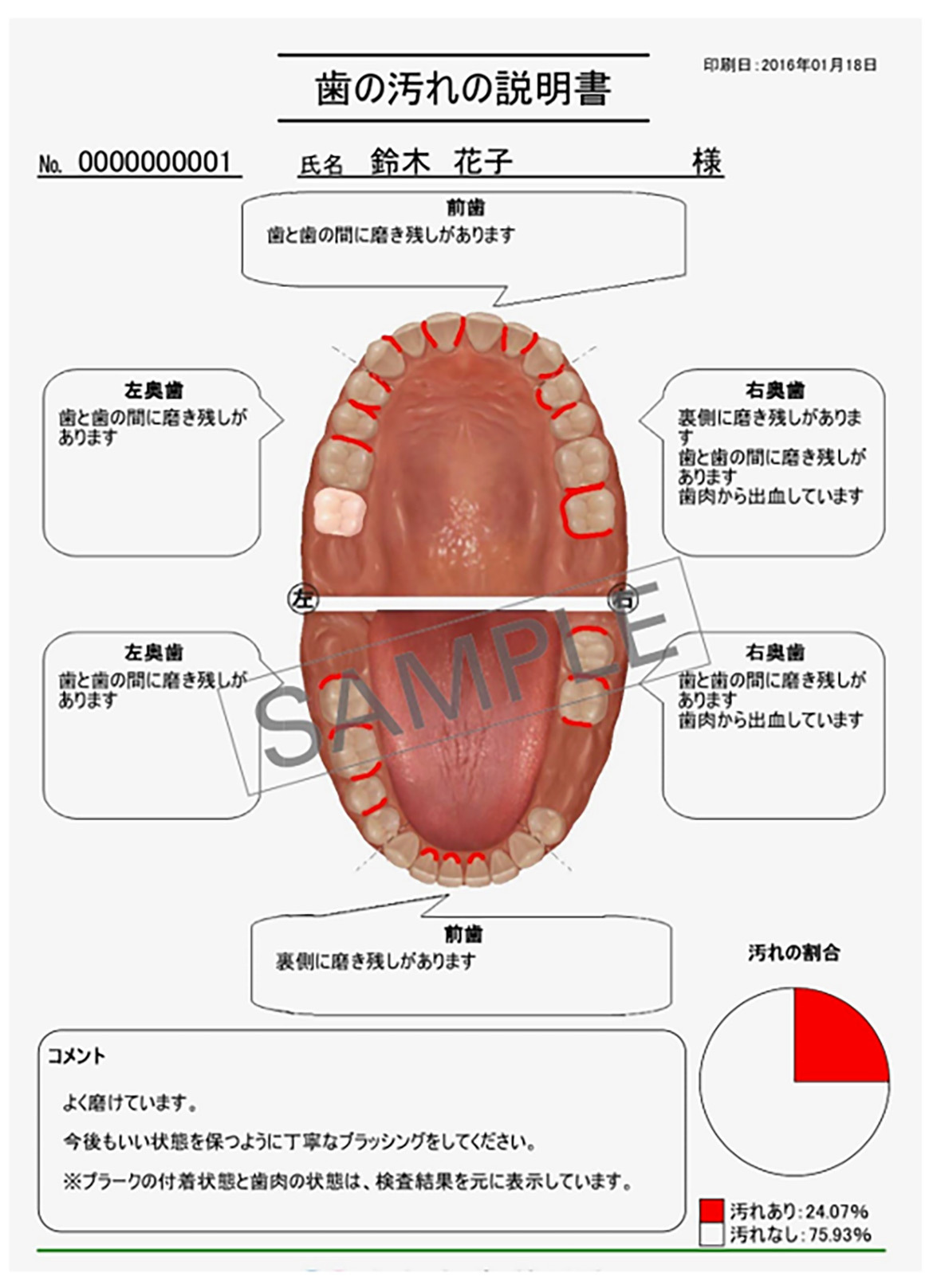 画像：歯の汚れの説明書