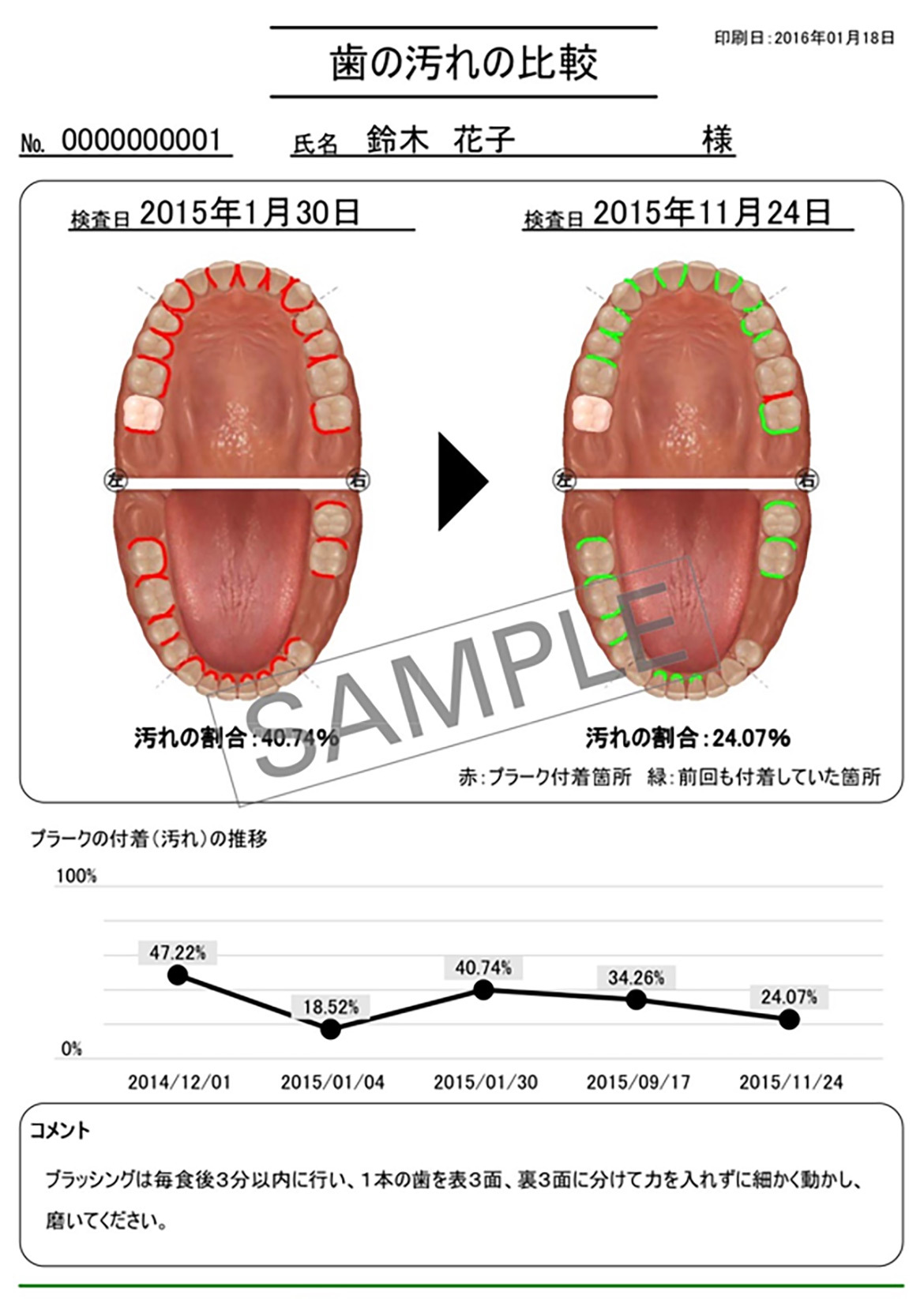 画像：歯の汚れの比較