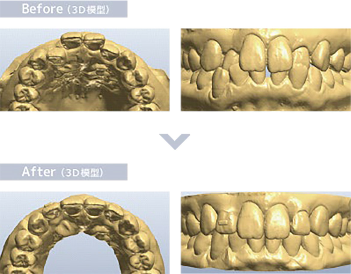 画像：Before（３D模型）After（３D模型）